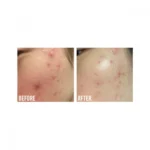 Beauty Of Joseon Calming Serum Green Tea Plus Panthenol, 30 Ml