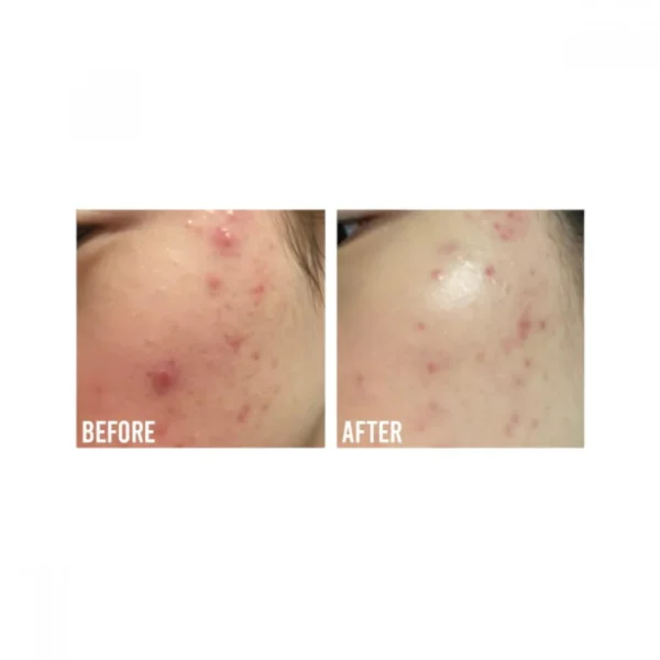 Beauty Of Joseon Calming Serum Green Tea Plus Panthenol, 30 Ml